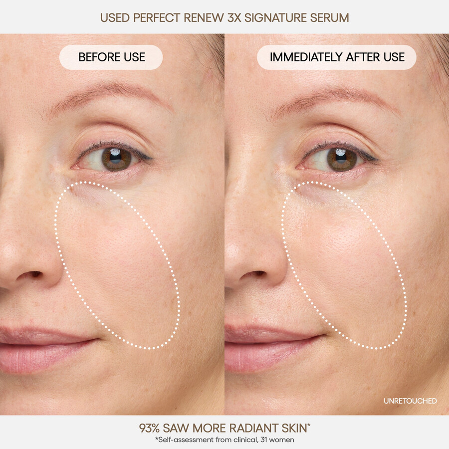 savršeni obnavljajući 3x signature serum
