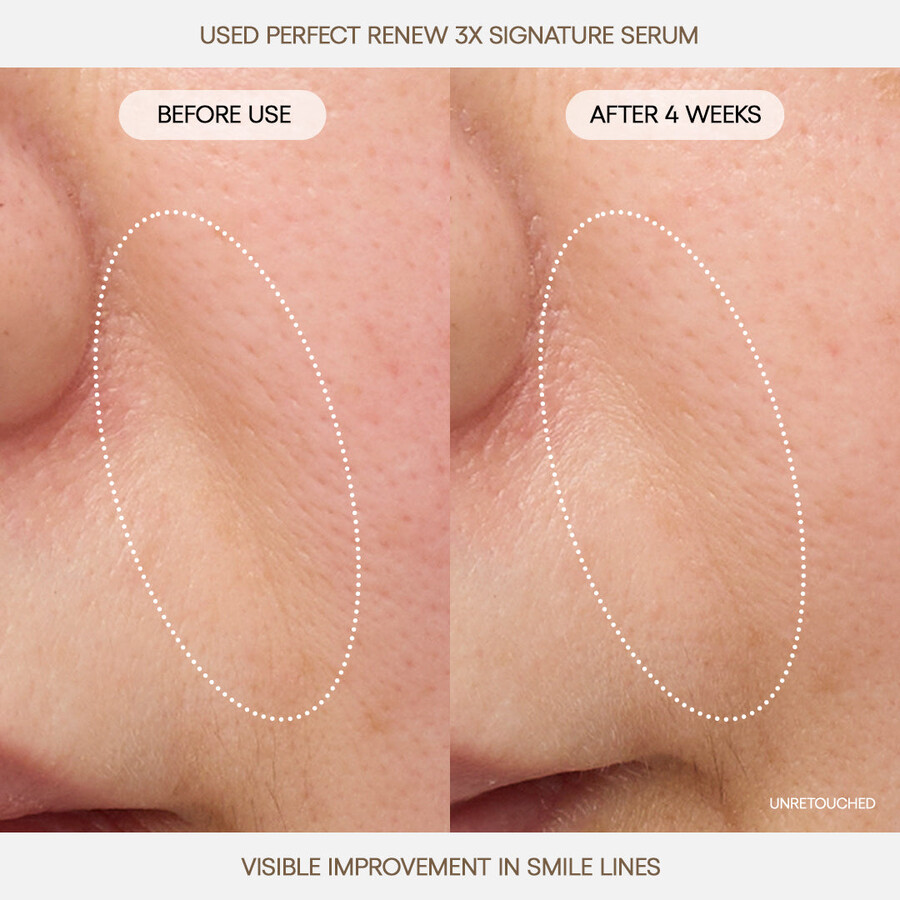 savršeni obnavljajući 3x signature serum